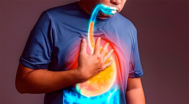 Enfermedad por reflujo gastroesofágico (ERGE)