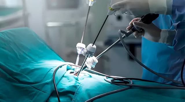 Cirugía laparoscópica (técnica de mínima invasión)